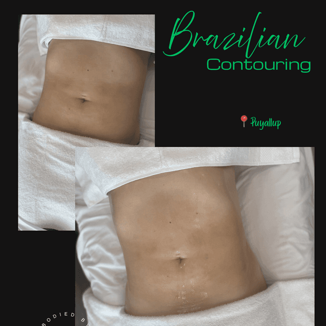Brazilian Lymphatic Experience at Bodied by Vixáge in Puyallup, WA